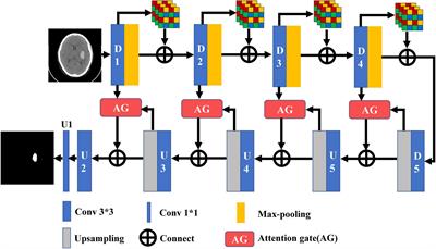 Deep learning-based computed tomography image segmentation and volume measurement of intracerebral hemorrhage